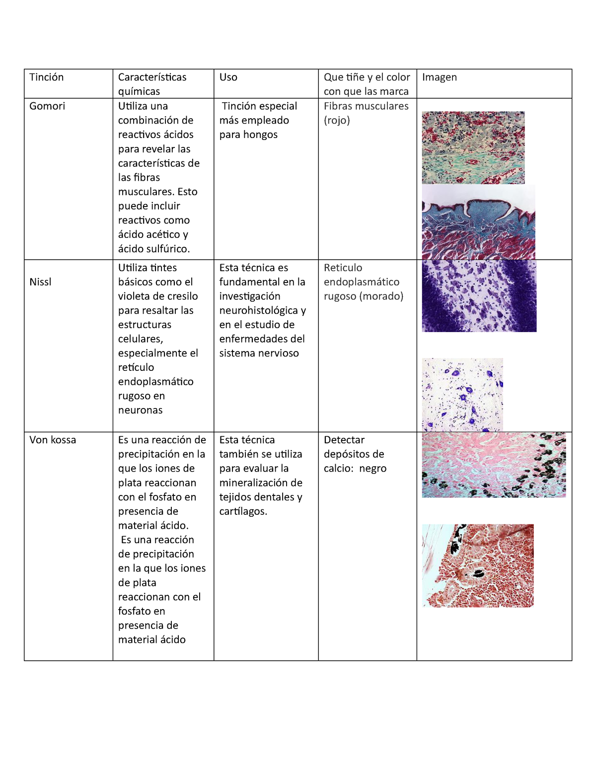 Tinción histologia espero y te sirva Tinción Características químicas Uso Que tiñe y el