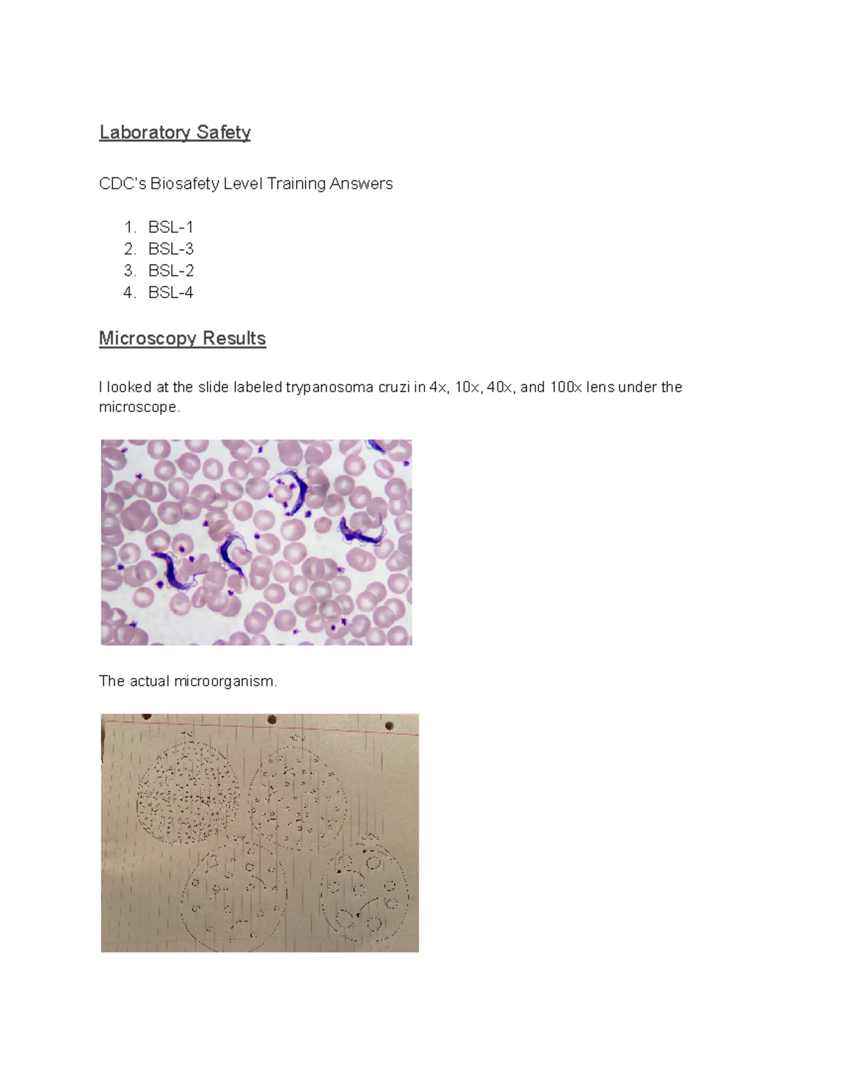 Microbio Lab Notebook 1 - Laboratory Safety CDC’s Biosafety Level ...