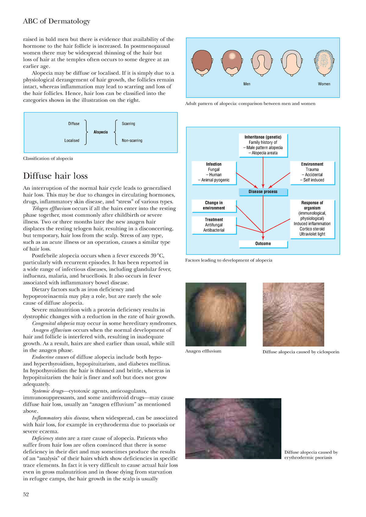 Dermatology-21 - Dermatology - ABC Of Dermatology 52 Raised In Bald Men ...