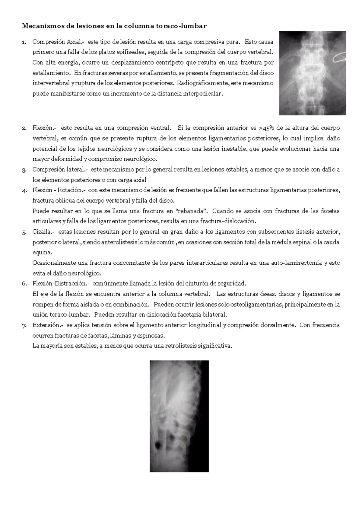 Material Rx Iii Do Y Er Parcial Mecanismos De Lesiones En La Columna Toraco Lumbar