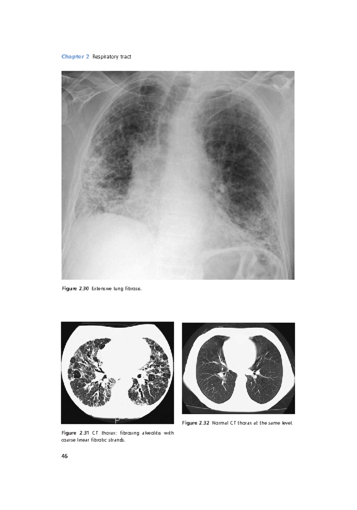 Radiology Lecture Notes pdf (16) - Chapter 2 Respiratory tract 46 ...