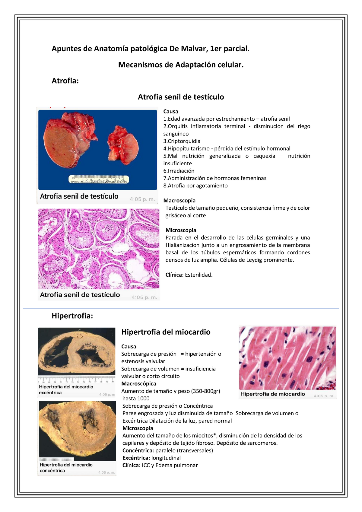 Apuntes De Anatomía Patológica De Malvar - Apuntes De Anatomía ...