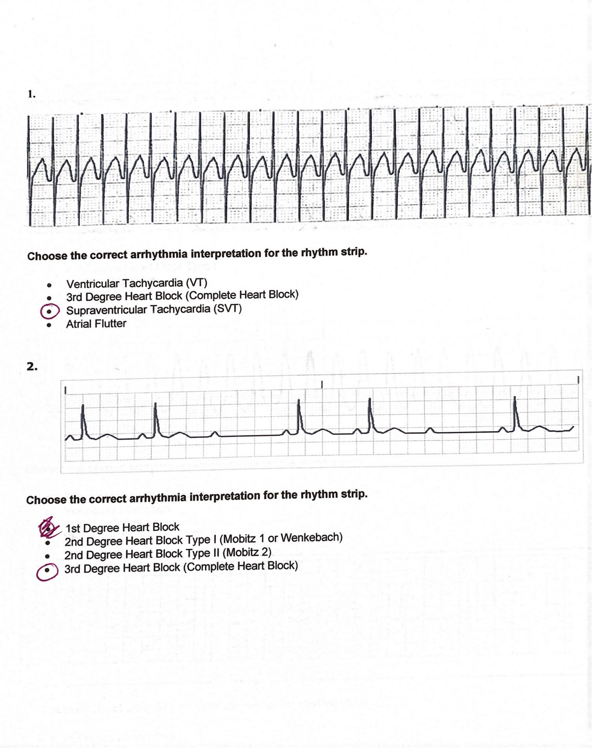 Arrhythmia EKG how to guide - NURN 160 - Studocu