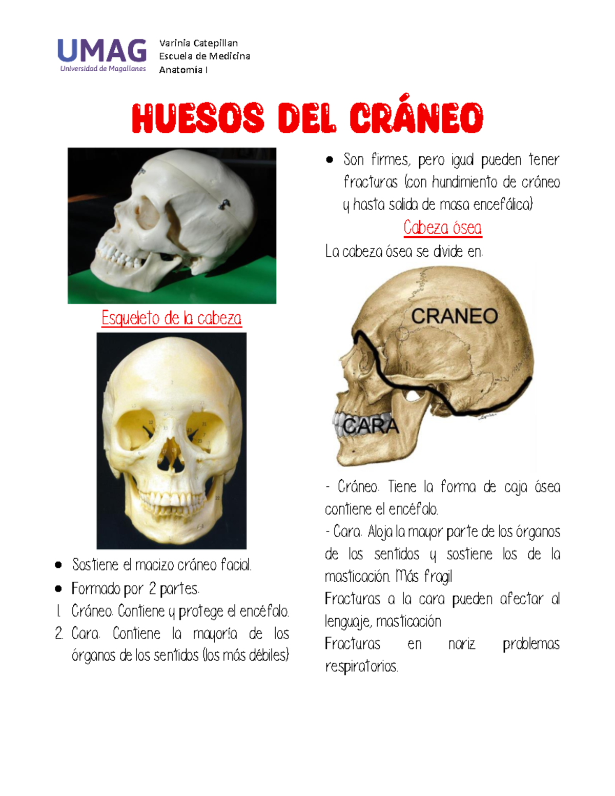 Huesos del cráneo - Varinia Catepillan Escuela de Medicina Anatomía I ...