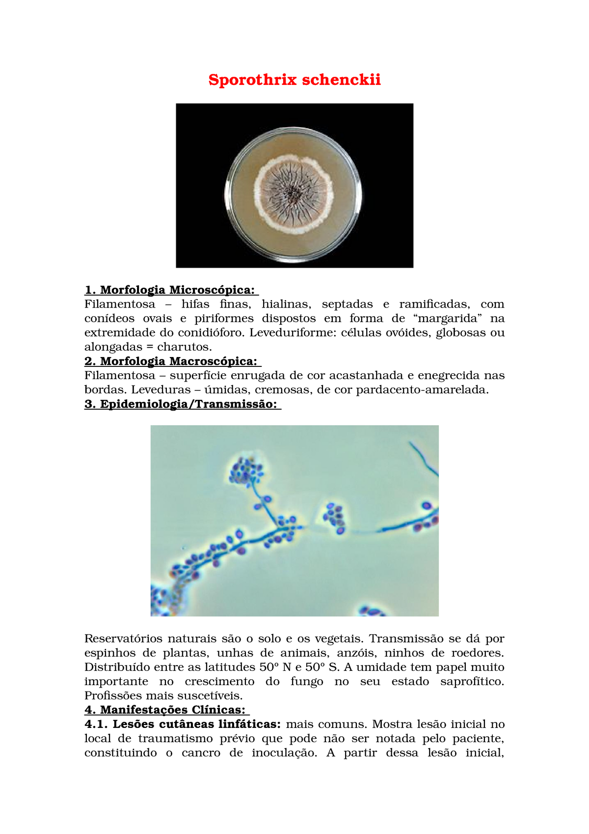 Sporothrix Schenckii Resumo Sobre Morfologia E Epidemiologia Da Bacteria Supracitada Studocu