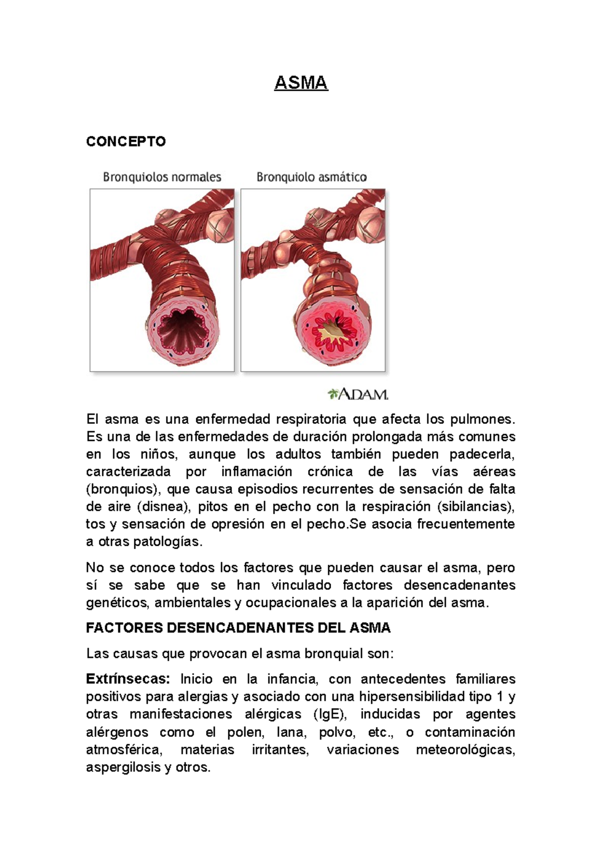 ASMA - Exposición Sobre él Asma - ASMA CONCEPTO El Asma Es Una ...