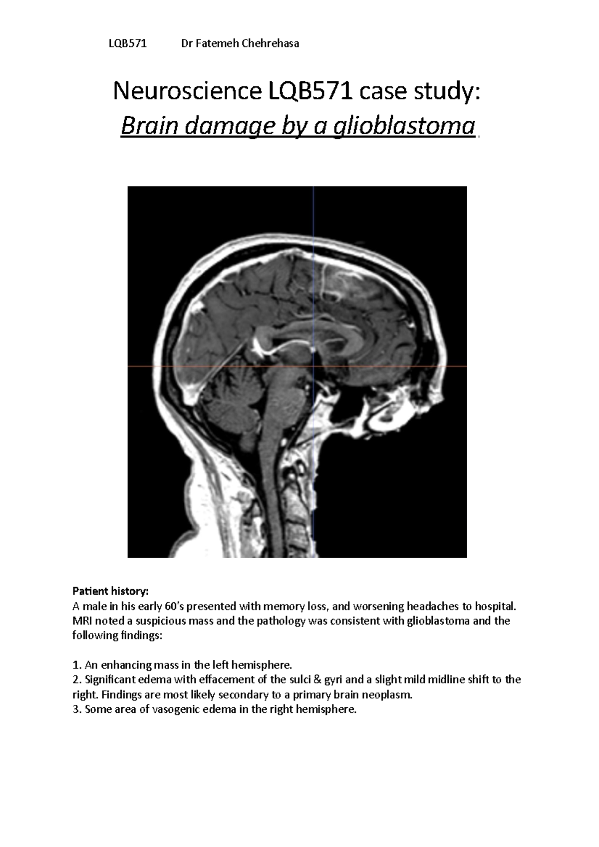 famous case study in neuroscience