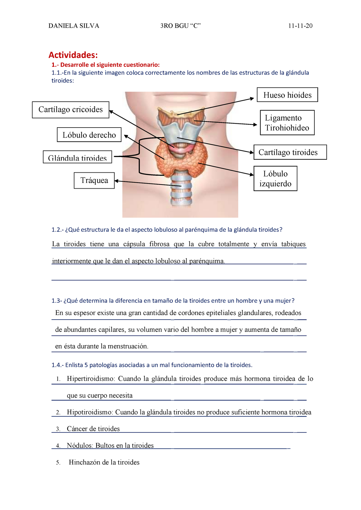 Acerca de la tiroides