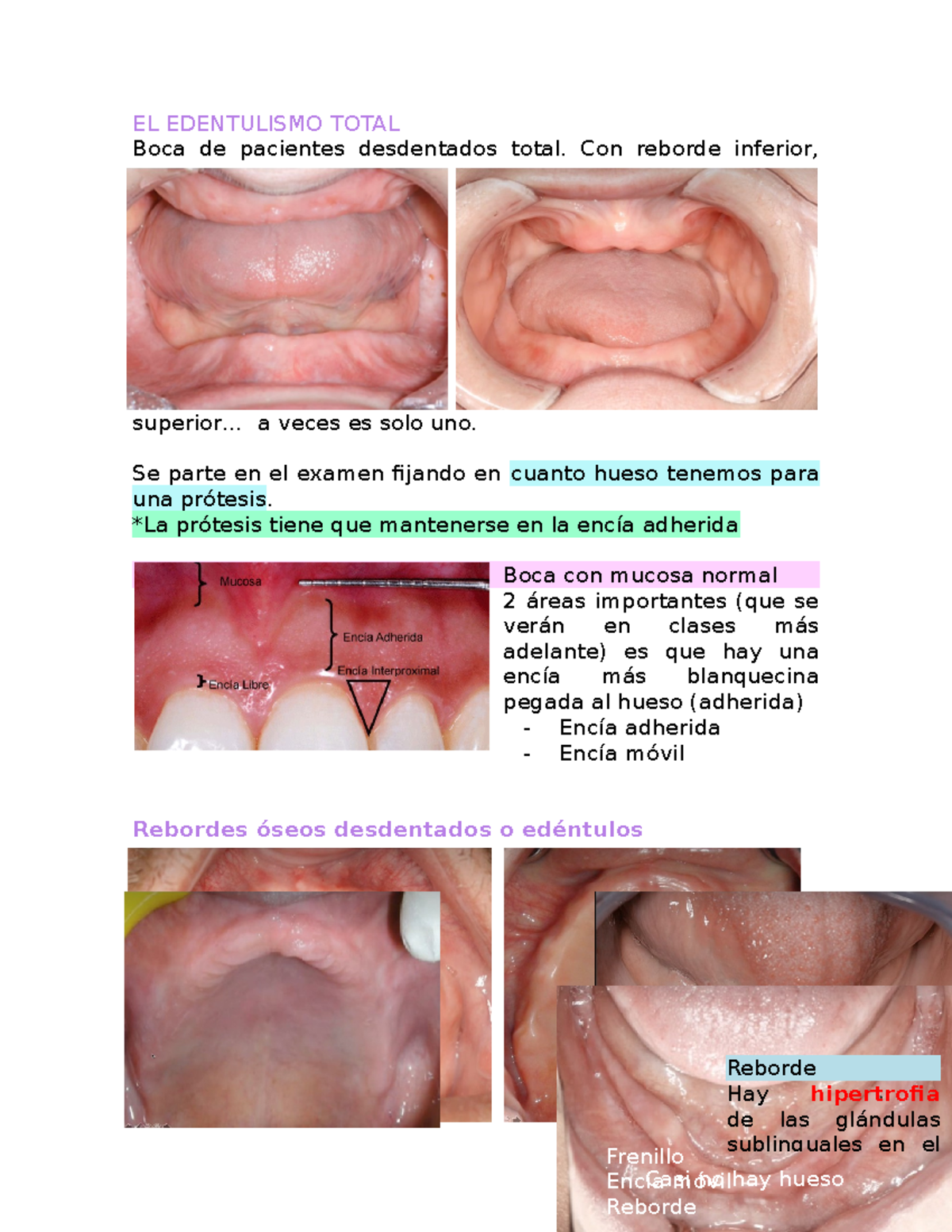 EL Edentulismo Total - apuntes randoms de clases, no entiendo para que ...