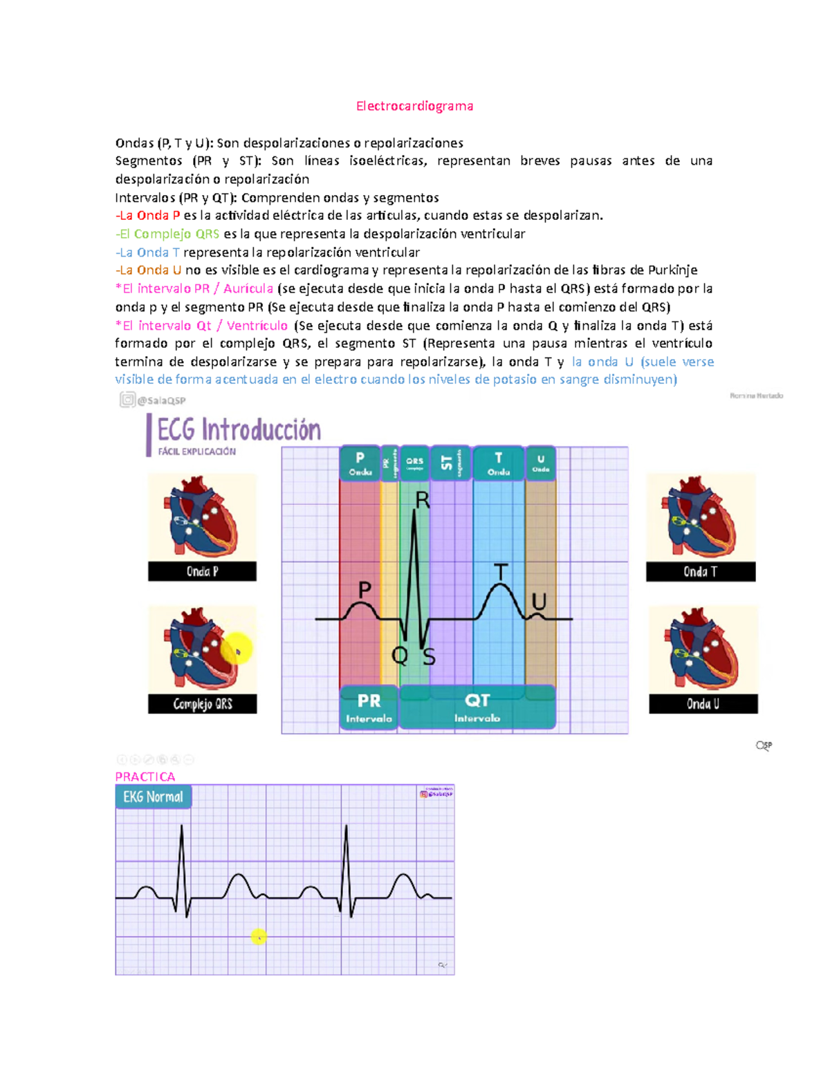 Electrocardiograma - Electrocardiograma Ondas (P, T Y U): Son ...