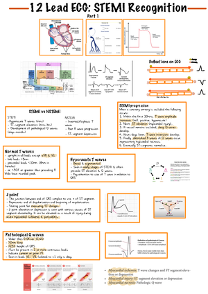 12-lead - 12-lead Ecg Interpretation - 12 Lead Ecg: Stemi Recognition 