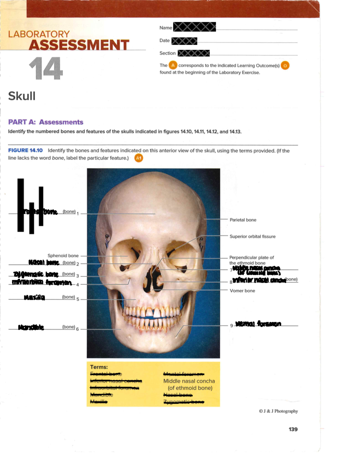 Lab Assessment 14-17 - Frontal bone Nasal bone Middle nasal concha ...