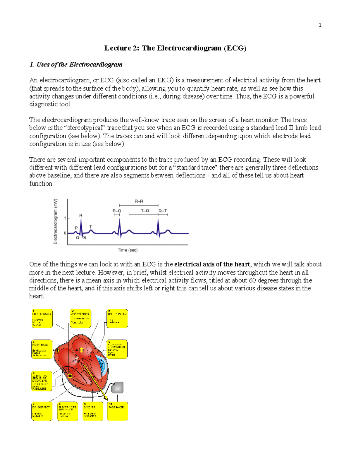 bioc34 Lecture 2 Notes 2022 - Lecture 2: The Electrocardiogram (ECG) 1 ...