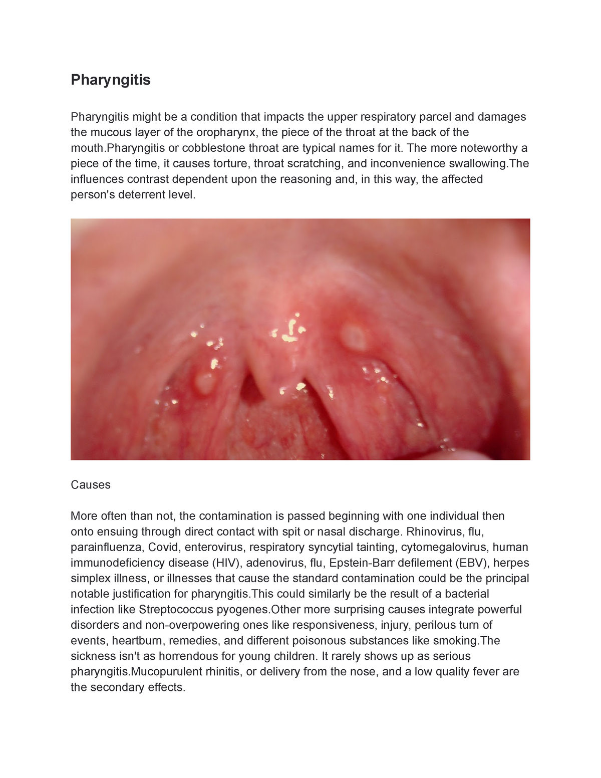 post nasal drip throat cobblestoning