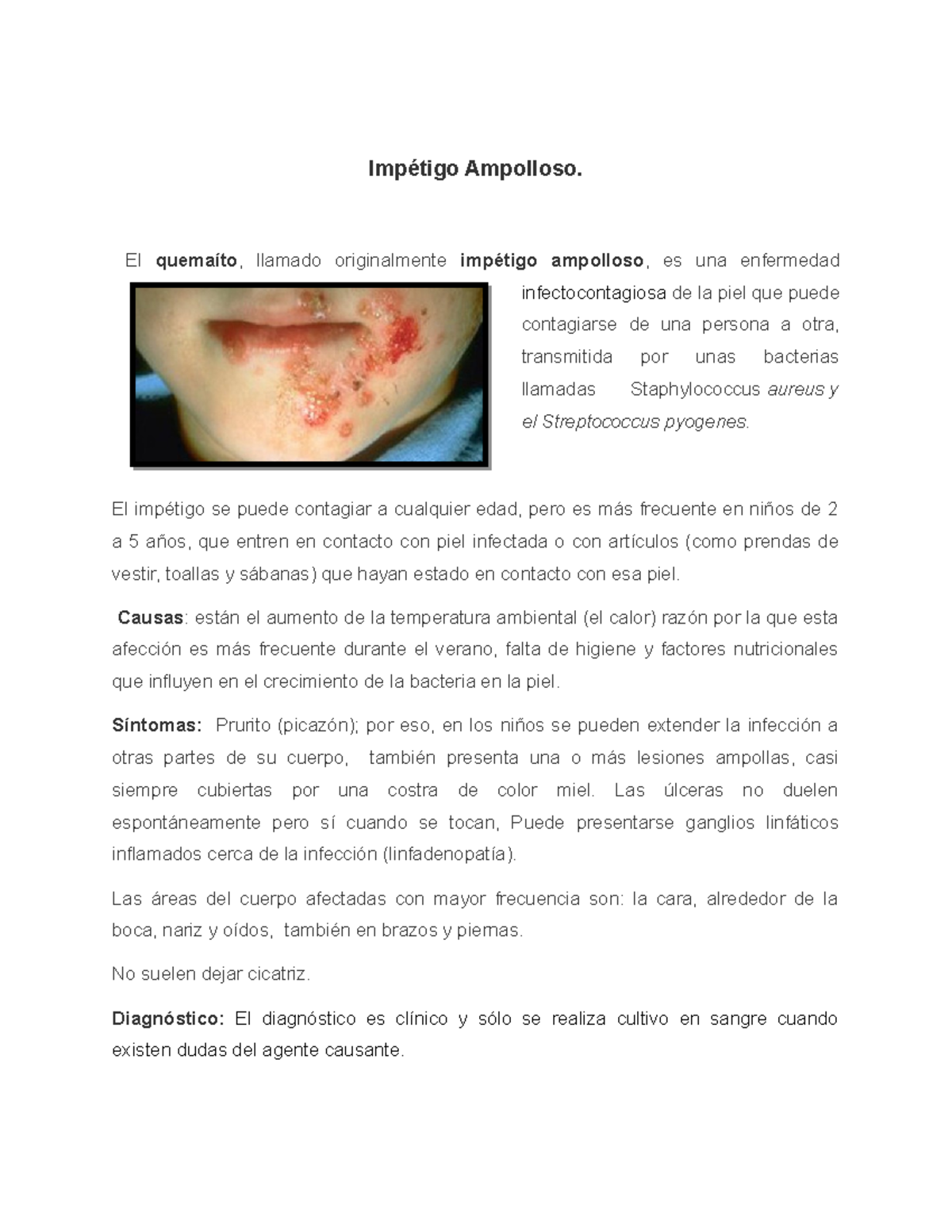 Quemaito o impetigo ampolloso - Ampolloso. El llamado originalmente ...