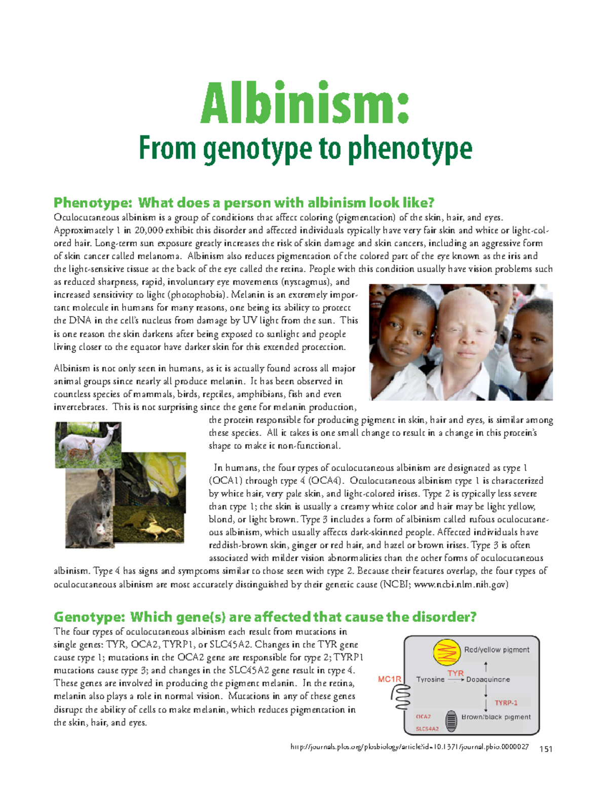 16-Albinism - Hhduqsahocdqw - Phenotype: What does a person with ...