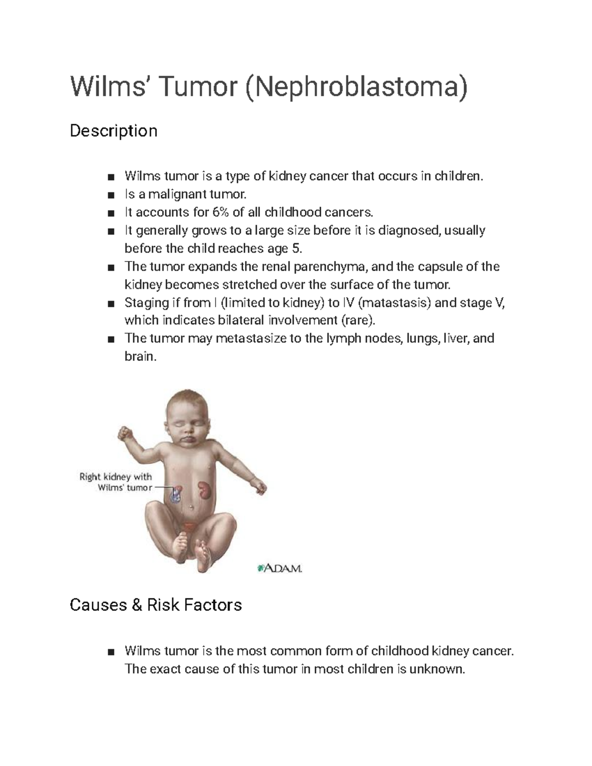 Wilms Tumor Nephroblastoma Wilms Tumor Nephroblastoma