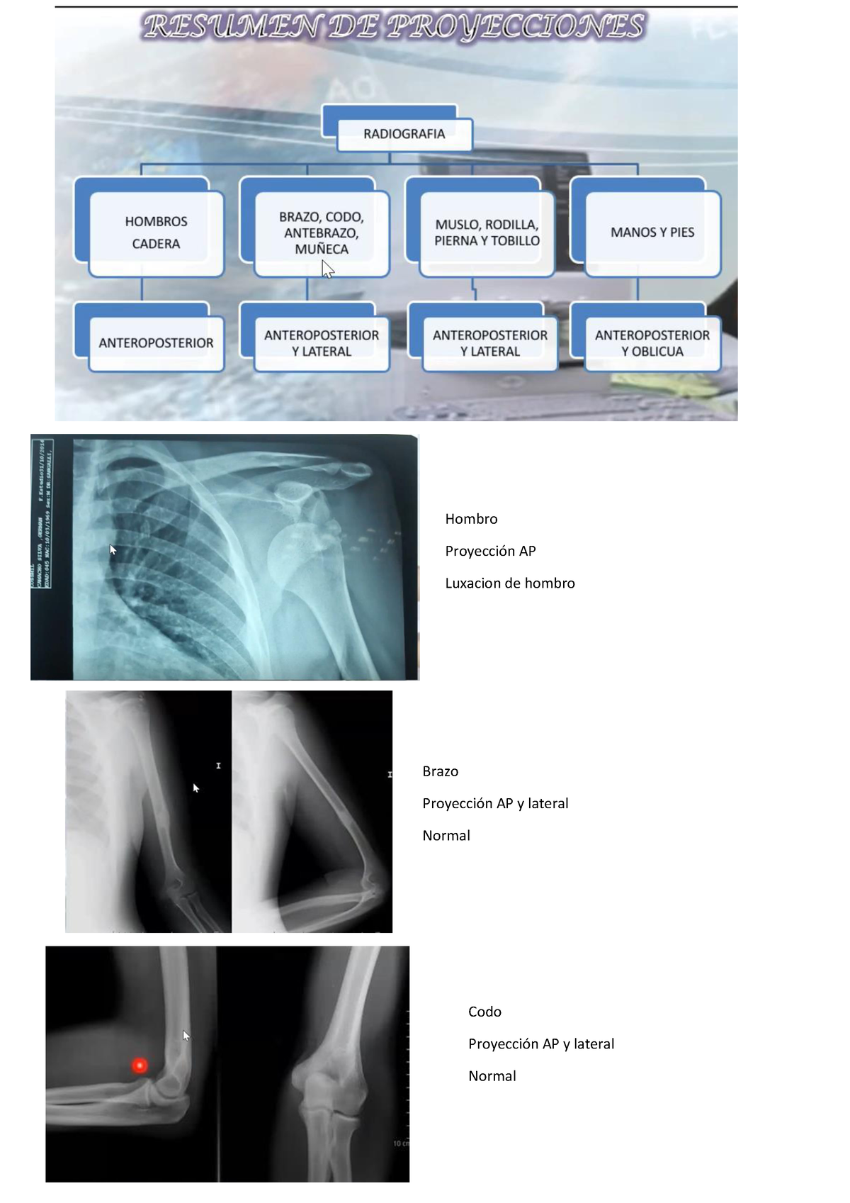 radiografía normal del antebrazo