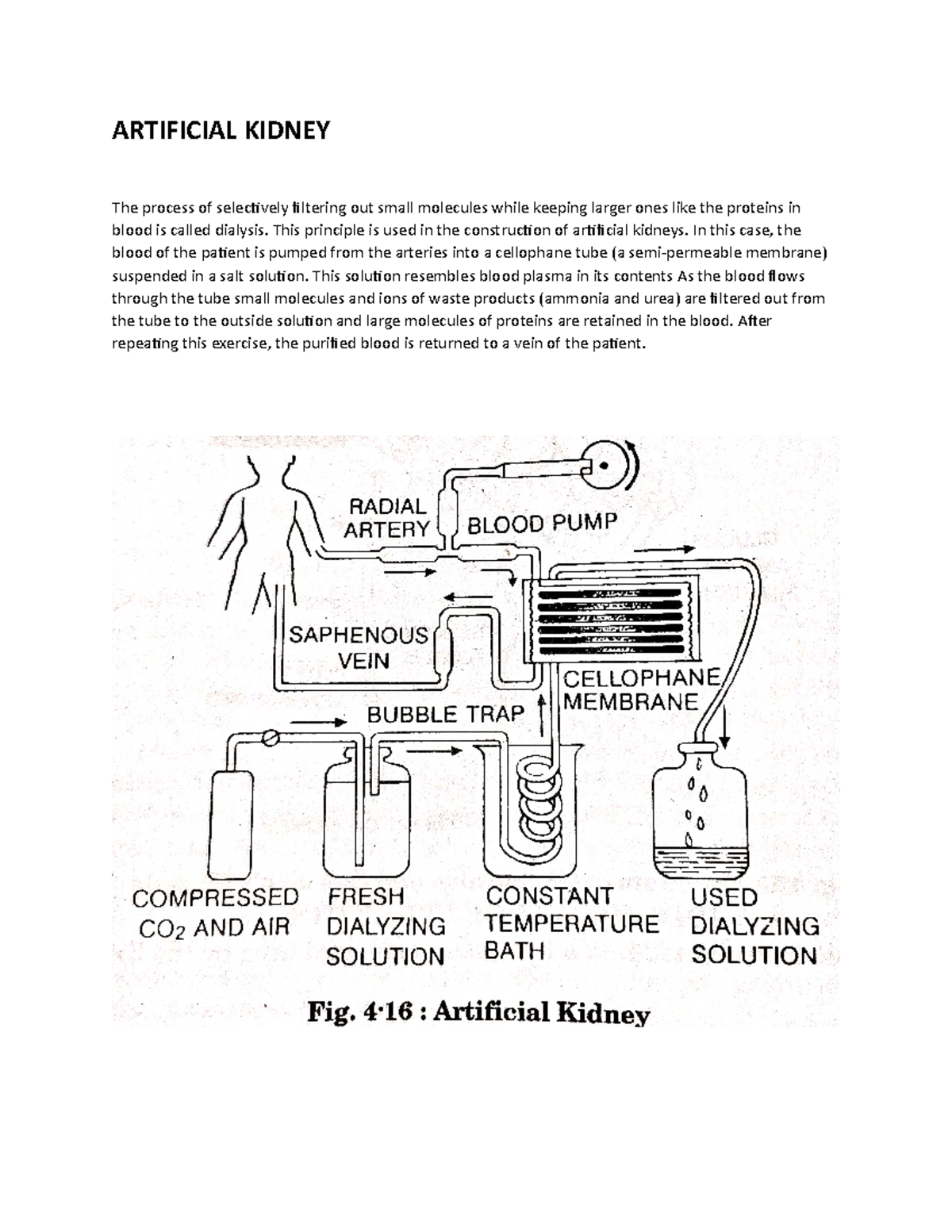 Artificial kidney ARTIFICIAL KIDNEY The process of selectively