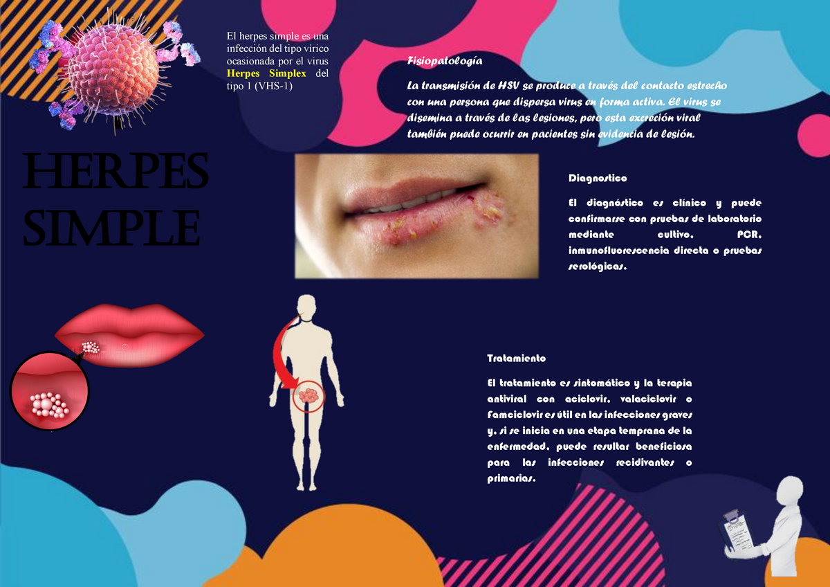 Infografia Virus Herpes Simple El Herpes Simple Es Una Infección Del Tipo Vírico Ocasionada 9312
