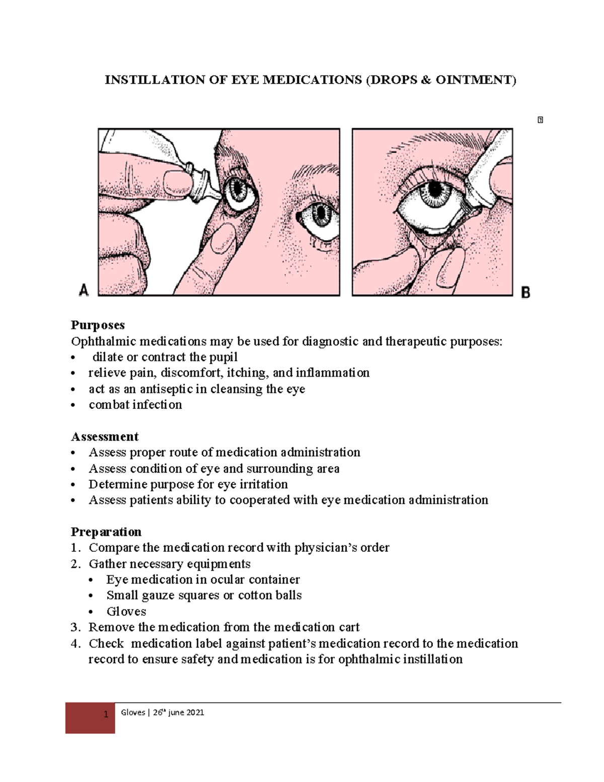 instillation-of-eye-drops-instillation-of-eye-medications-drops