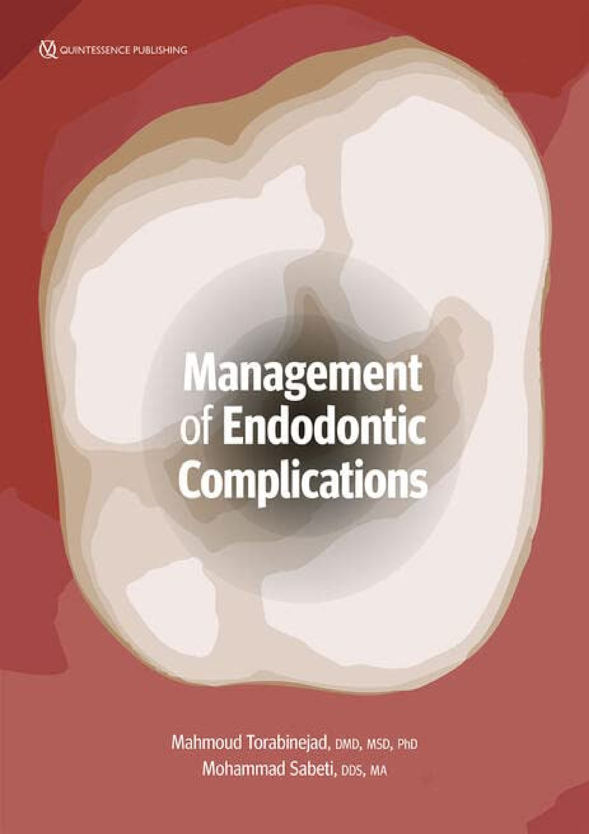 Read ebook [PDF] Management of Endodontic Complications From Diagnosis