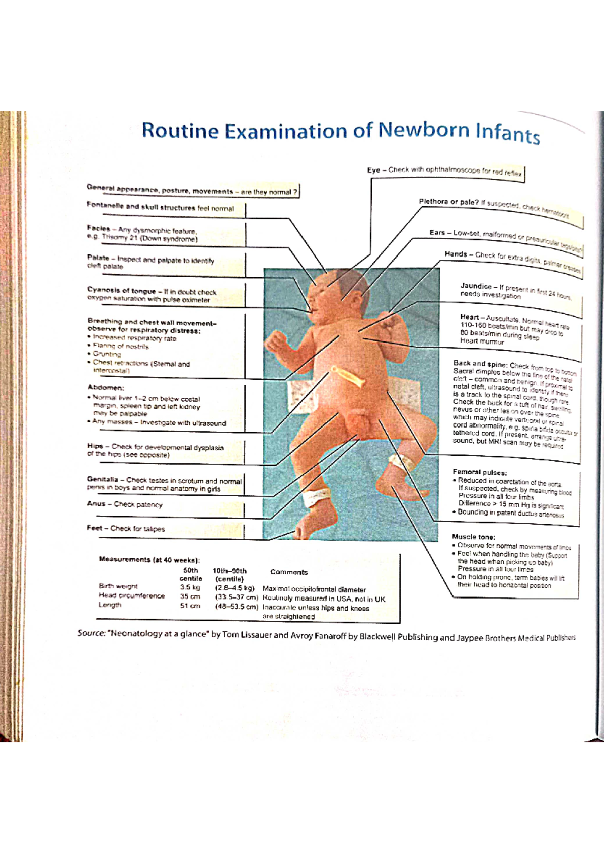 Newborn assessment Nursing Studocu