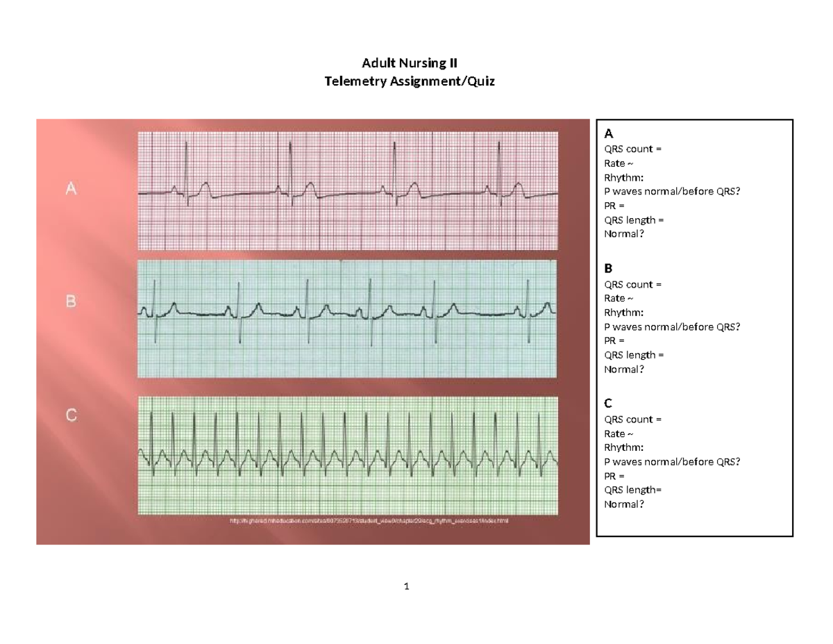 Telemetry Strips 1 - Notes - NUR 231 - Adult Nursing II Telemetry ...