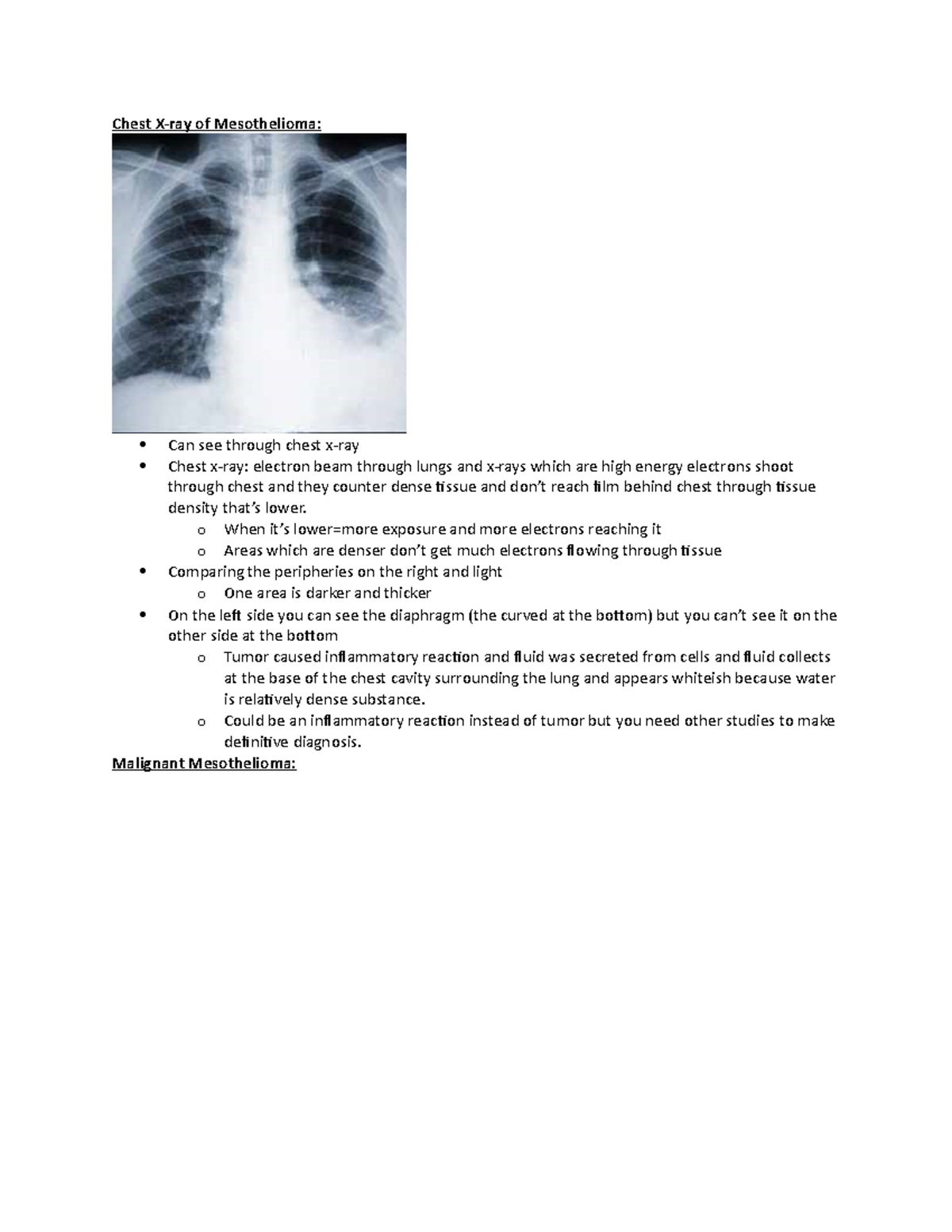 How Do You Detect Costochondritis