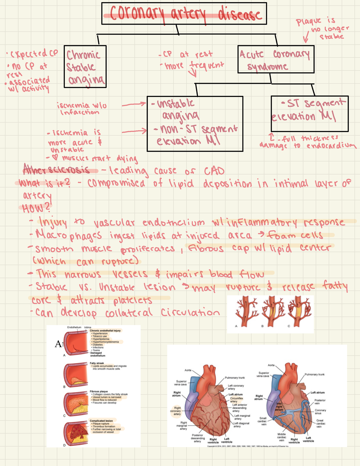 Coronary Artery Disease - BIO 222 - StuDocu