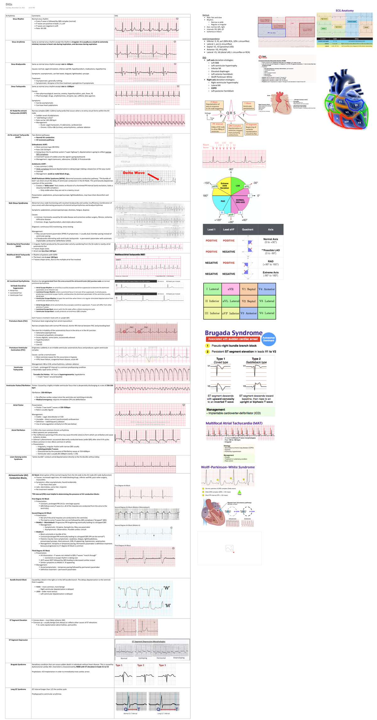 EKGs - EKG summary - Arrhythmia Comments EKG Sinus Rhythm Normal sinus ...