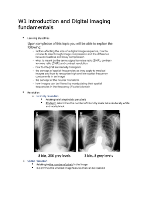 W2 Digital radiography - film blackening Digital: grey level value ...