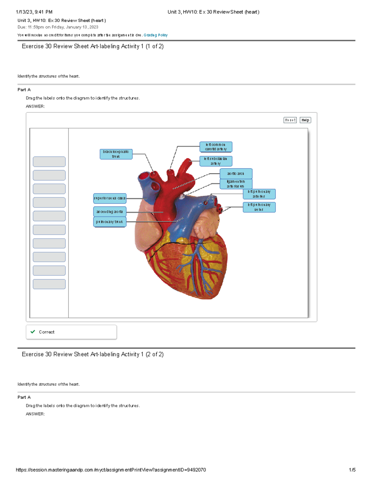 Unit 3 HW10 Ex 30 Review Sheet heart Unit 3 HW10 Ex 30 Review 