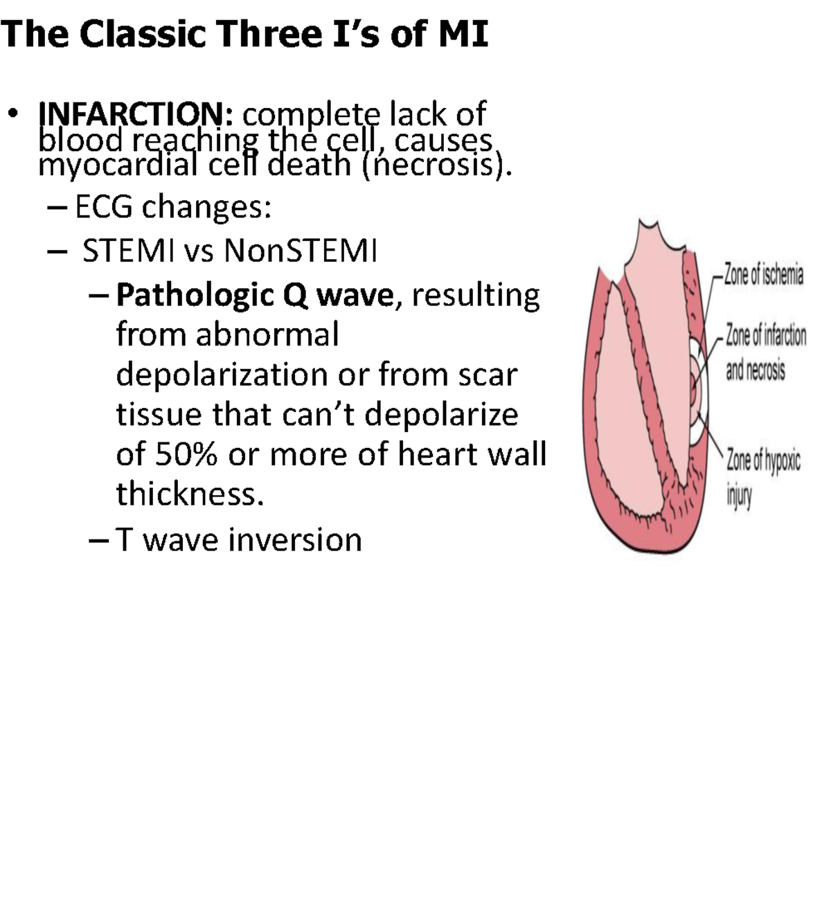 NURS 1002 Part 3 - lecture notes - The Classic Three I’s of MI ...
