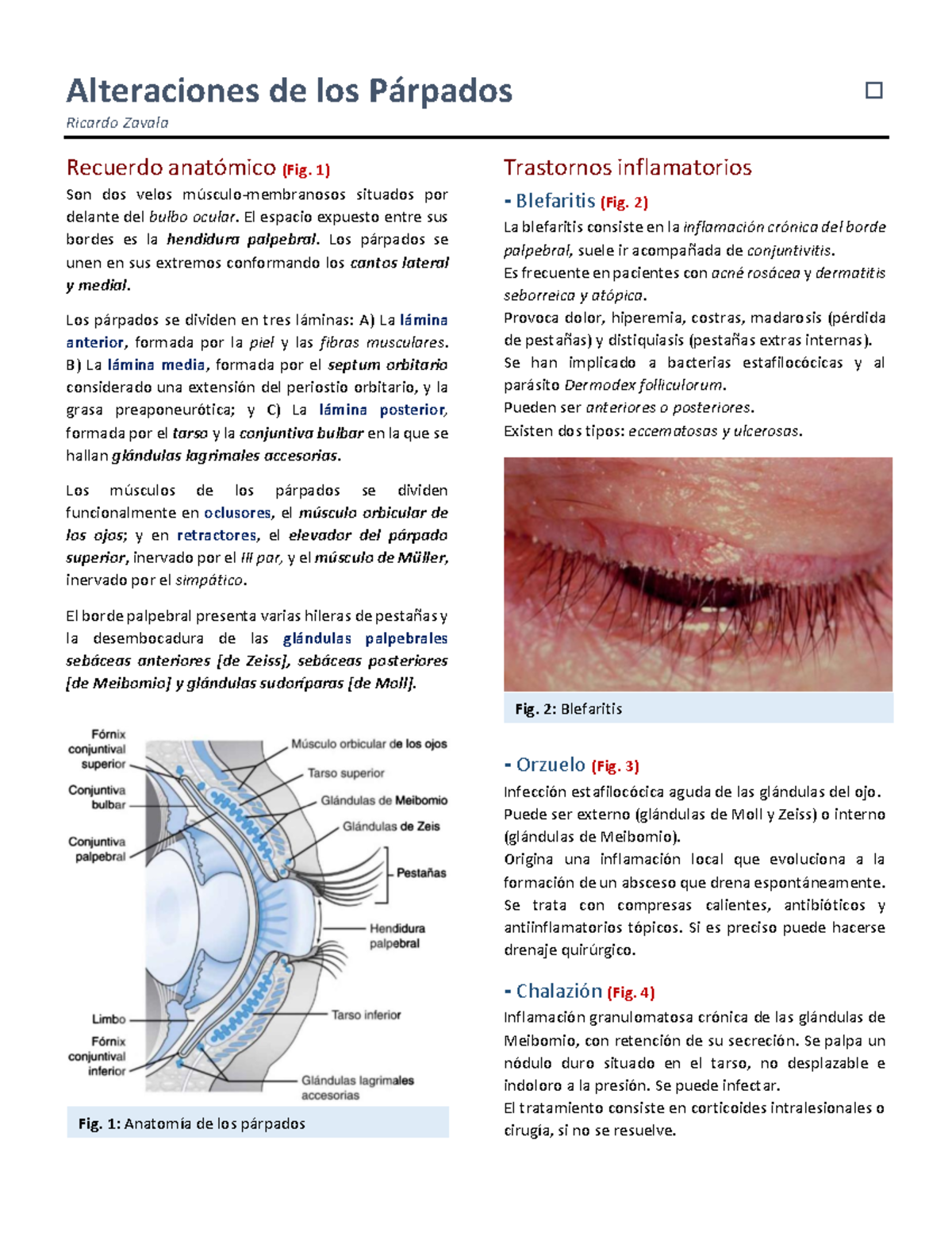 edema palpebral alergico tratamiento edema palpebral alergico tratamiento