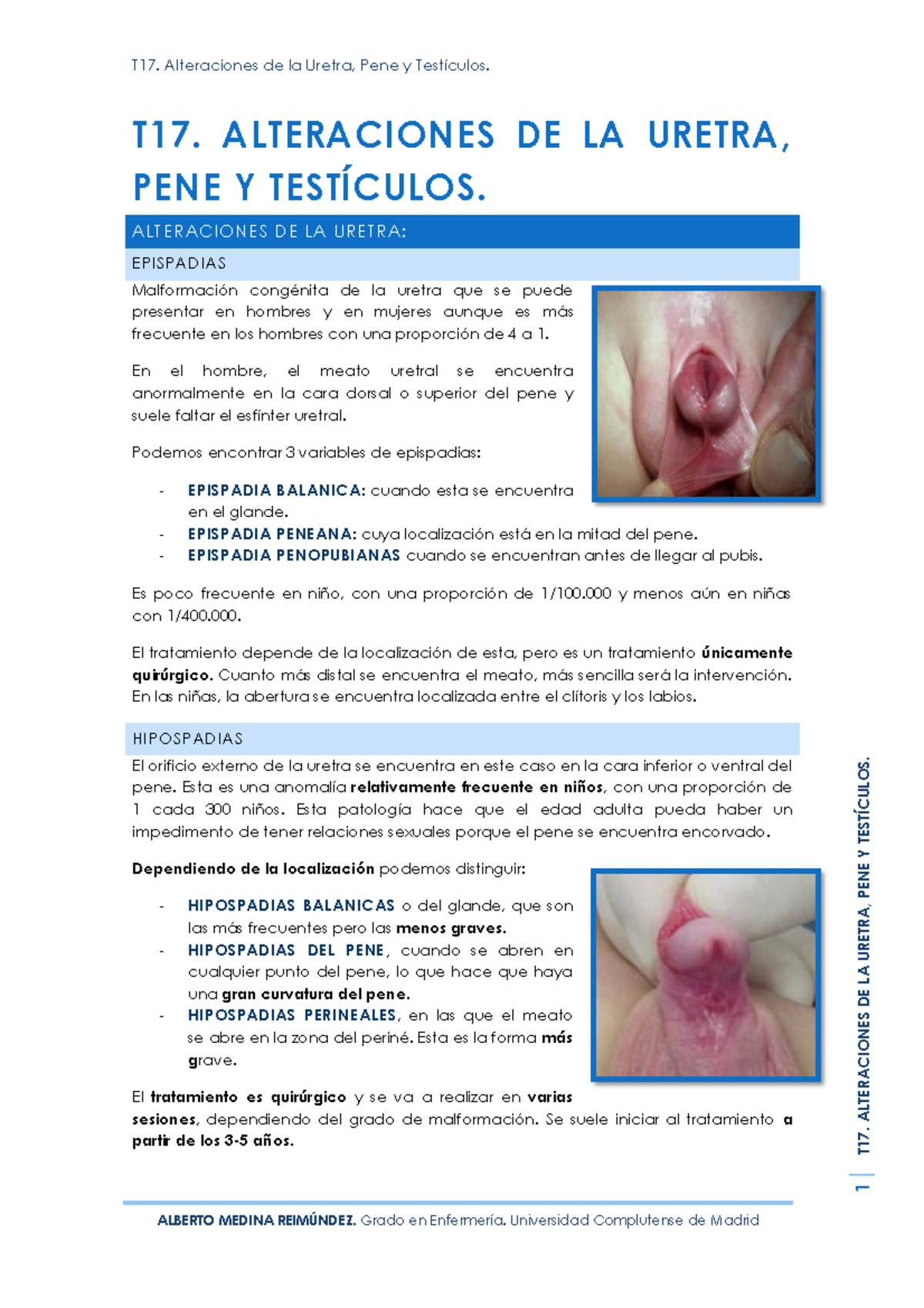 abertura de la uretra