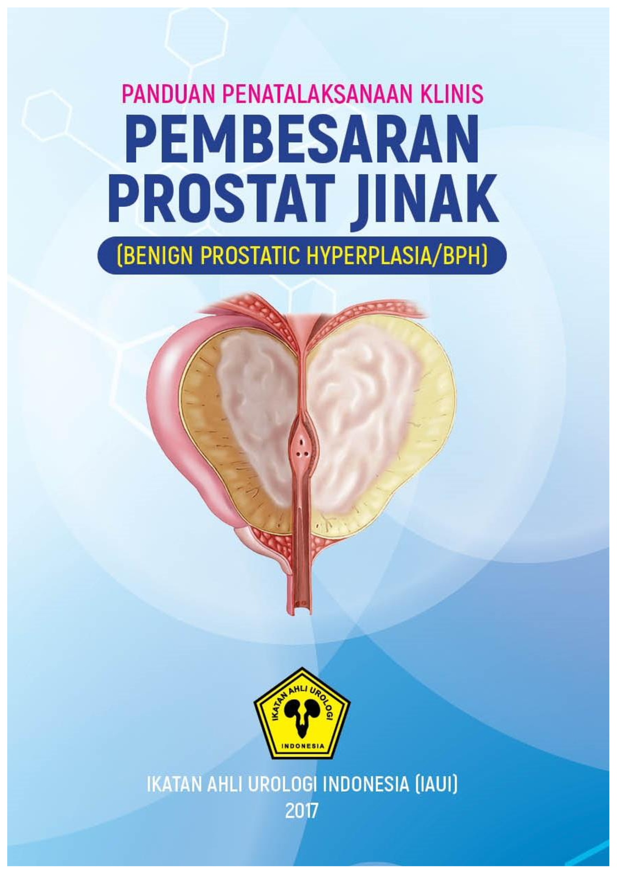 BPH - Materi BPH - I Panduan Penatalaksanaan Klinis Pembesaran Prostat ...