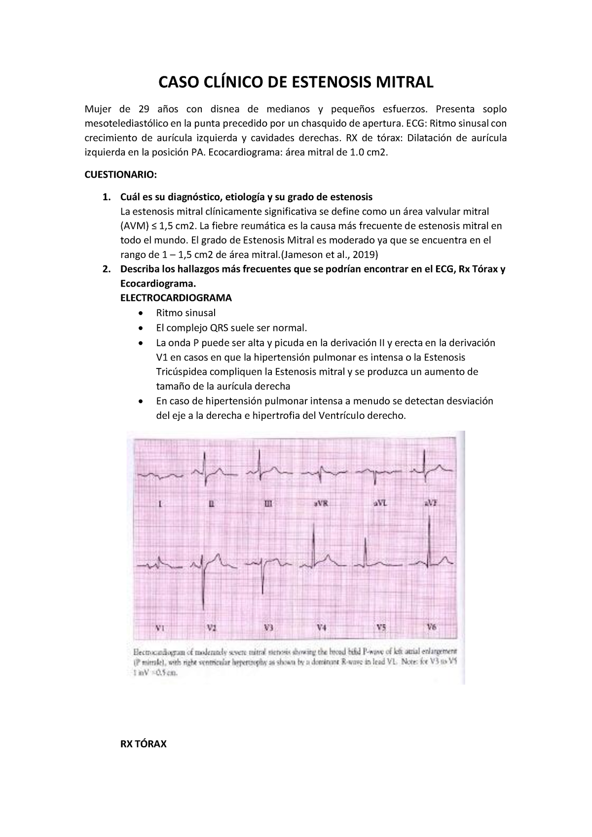 W Caso Clinico De Val Mitral Cardiologia Caso Cl Nico De Estenosis Mitral Mujer De