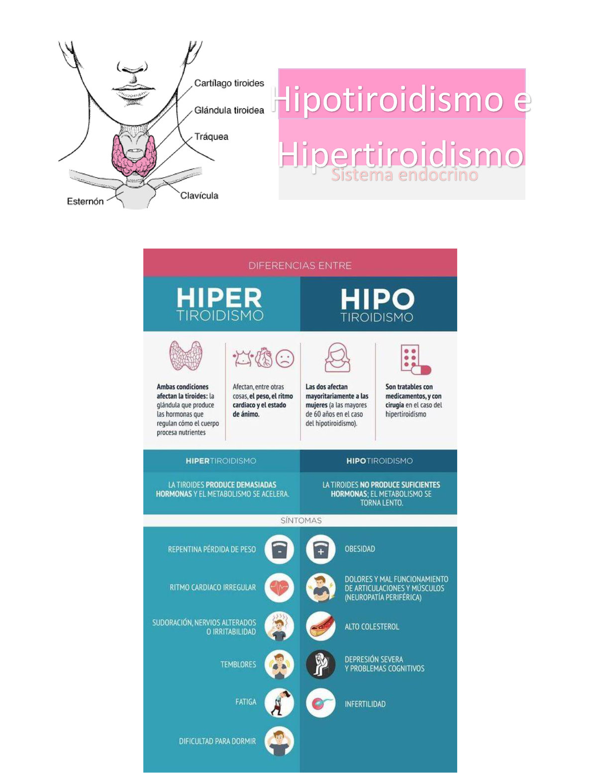 Hipotiroidismo- Hipertiroidismo - Sistema Endocrino Hipotiroidismo E ...