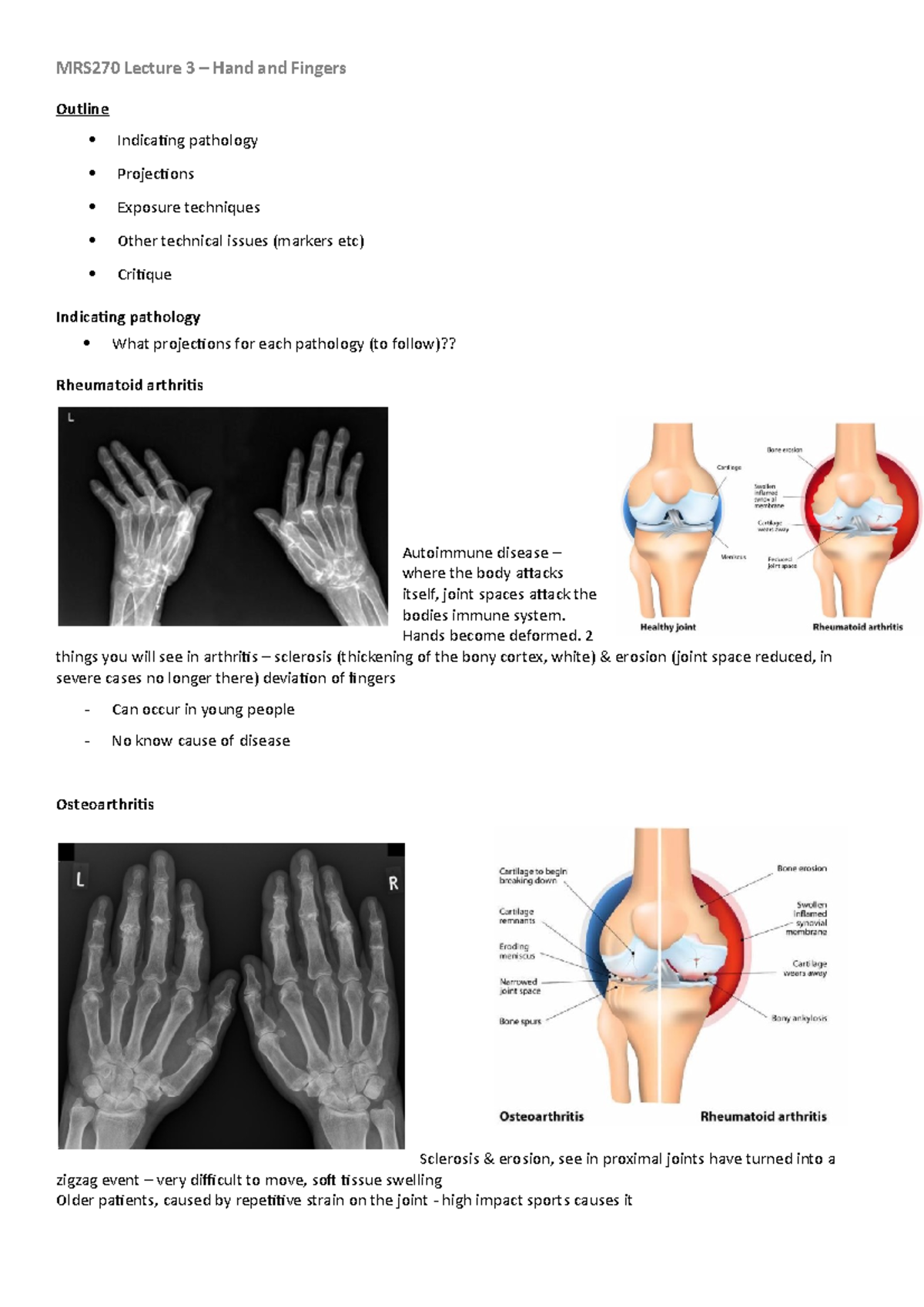 MRS270 Lecture 3 - hands - MRS270 Lecture 3 – Hand and Fingers Outline ...