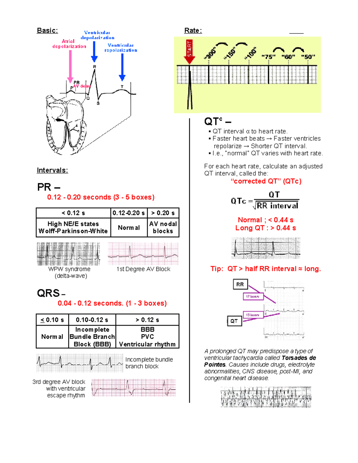 A Simplified Ecg Guide - Terrific Resource to study. - Basic: Rate ...