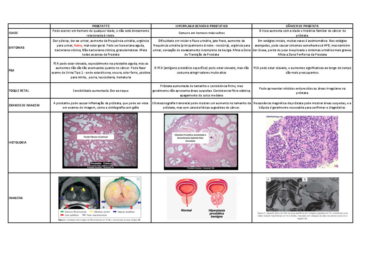 MAPA Comparativo Prostatite HBP E CA Prostata - PROSTATITE HIPERPLASIA ...