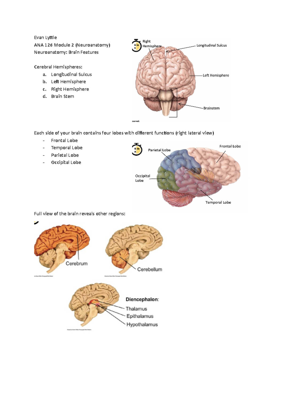 Brain Features (need to finish) - Evan Lyttle ANA 126 Module 2 ...