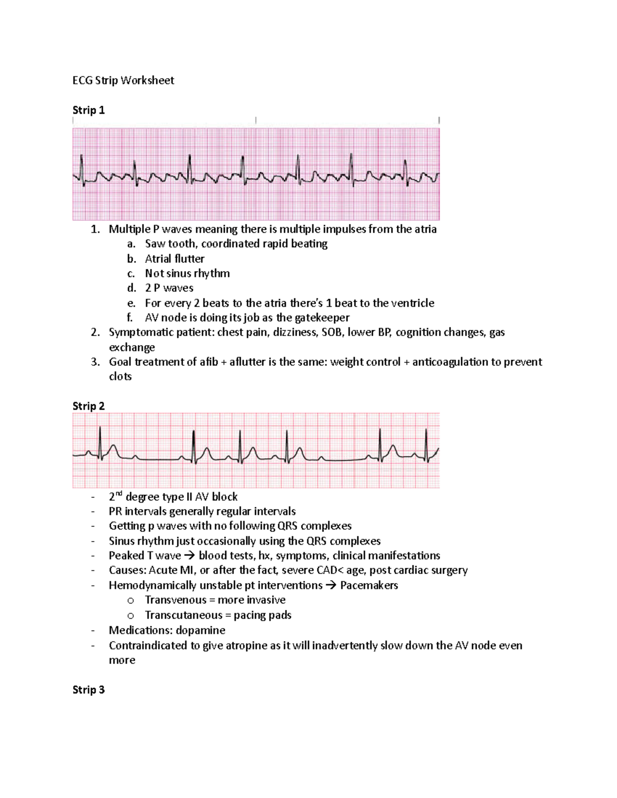 NN ECG Strip Worksheet - ECG Strip Worksheet Strip 1 Multiple P waves ...