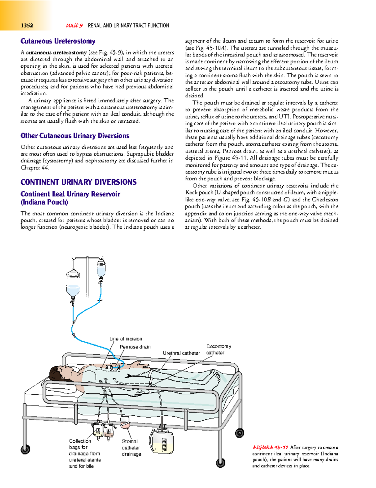 Textbook of medical surgical nursing-137 - Cutaneous Ureterostomy A ...