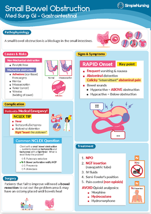 Myocardial Infarction - Concept Map - ACTIVE LEARNING TEMPLATES System ...