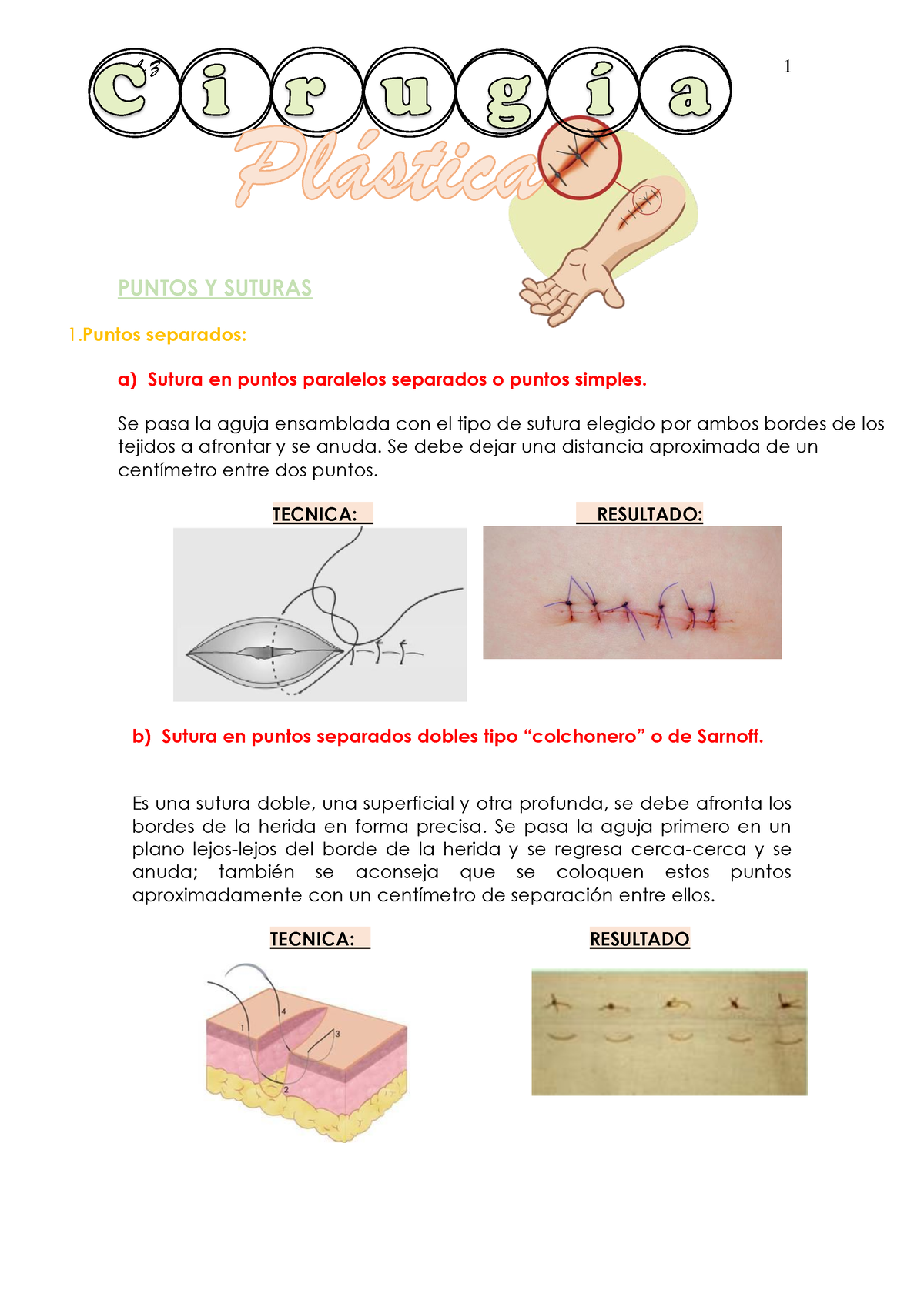 Suturas Cirugia - B) Sutura En Puntos Separados Dobles Tipo “colchonero ...