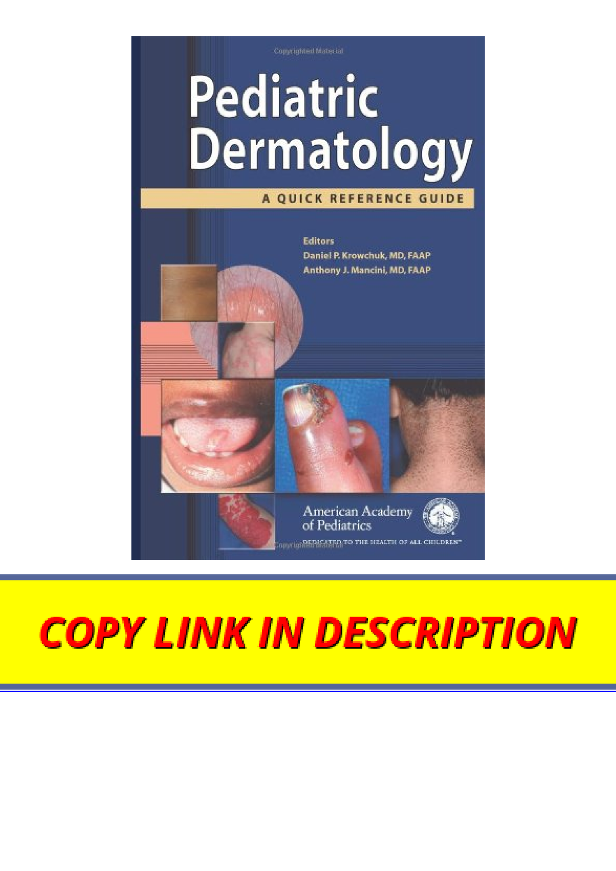 Ebook download Pediatric Dermatology A Quick Reference Guide unlimited ...