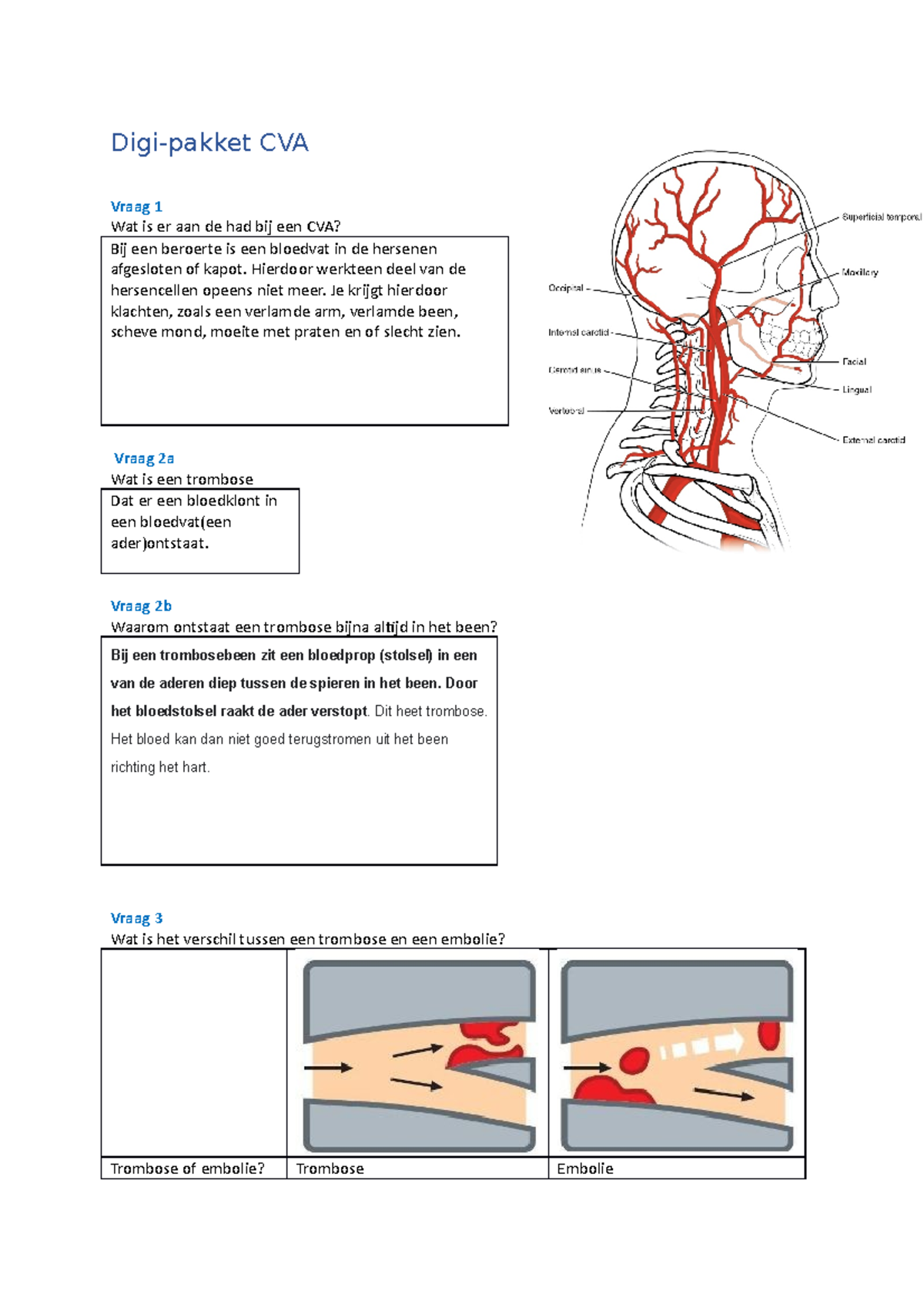 Digi-pakket CVA - anatomie - Digi-pakket CVA Vraag 1 Wat is er aan de ...