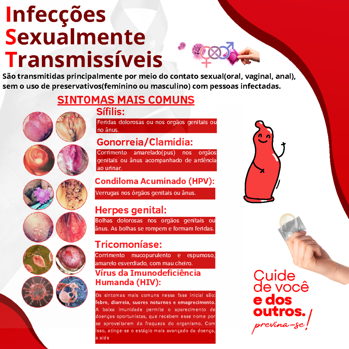 ISTS - BANNER EXPLICATIVO DE ISTS - Gonorreia/Clamidia: Corrimento ...